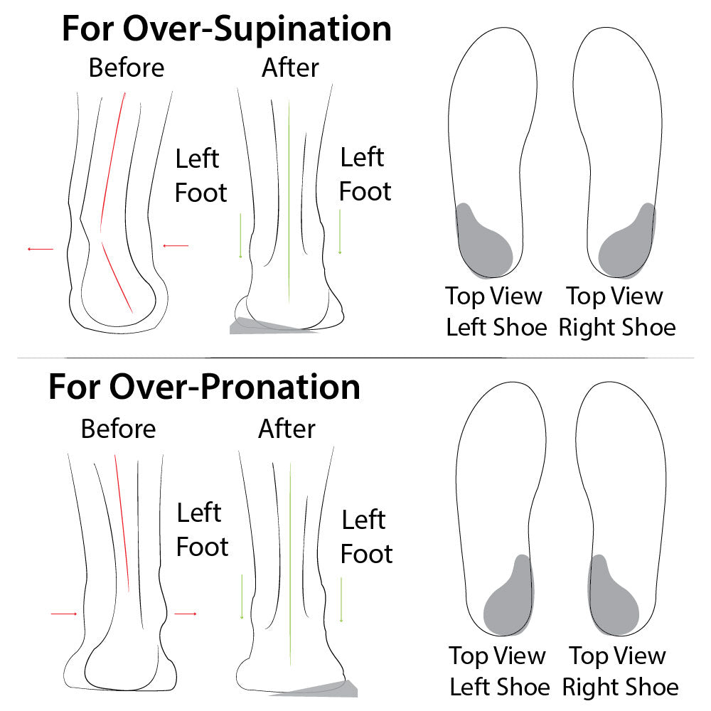 Heel Wedge (re-usable Adhesive)