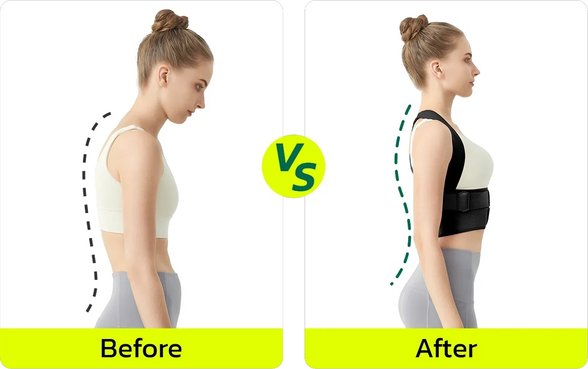 Lushlace Posture Corrector